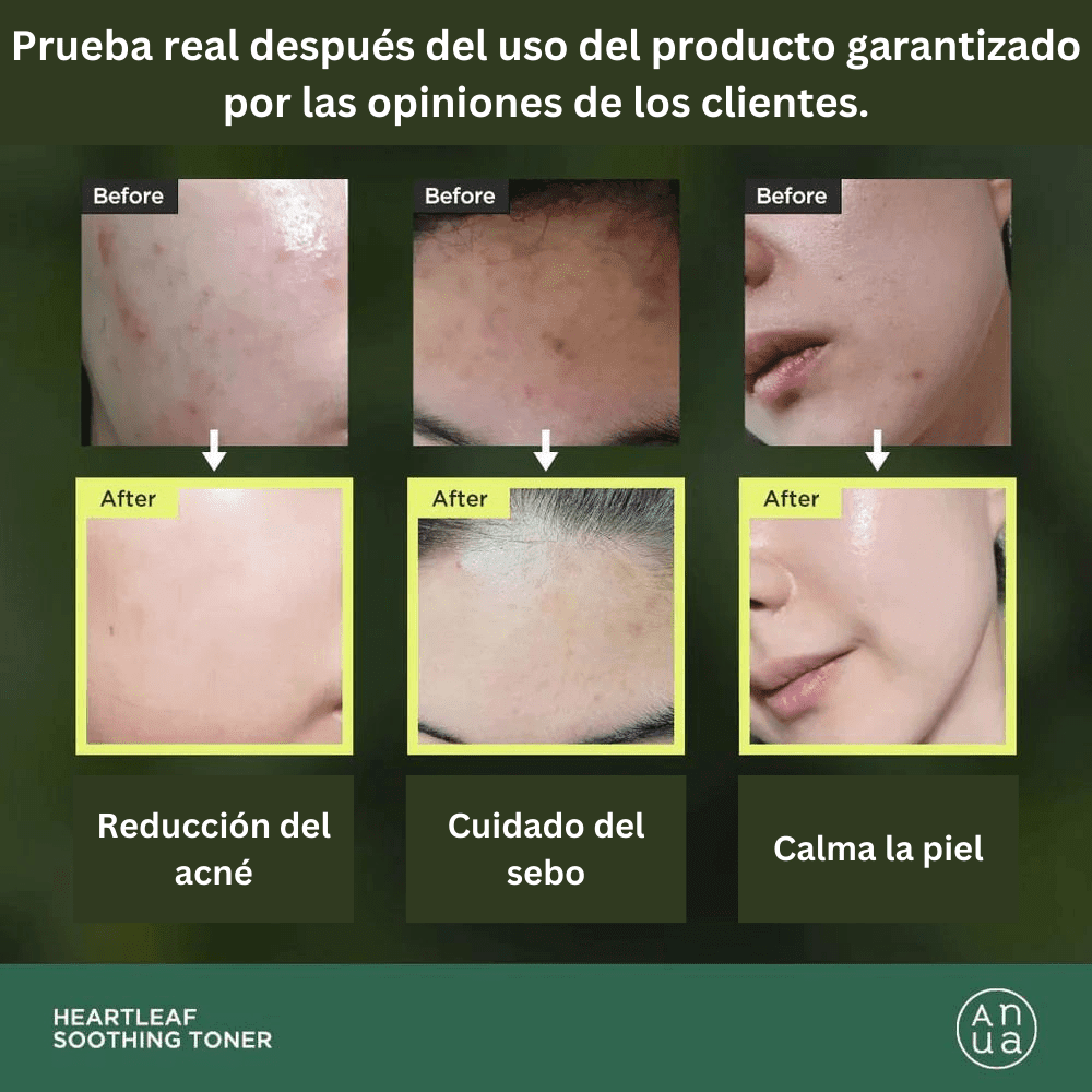 [Anua Best Kit] Anua: Aceite Limpiador & Tónico Calmante - ANUA - NADAUN - 