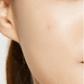 Acne Pimple Master Patch 1 pieza (Parches para acné) - COSRX - NADAUN - 8809416470245