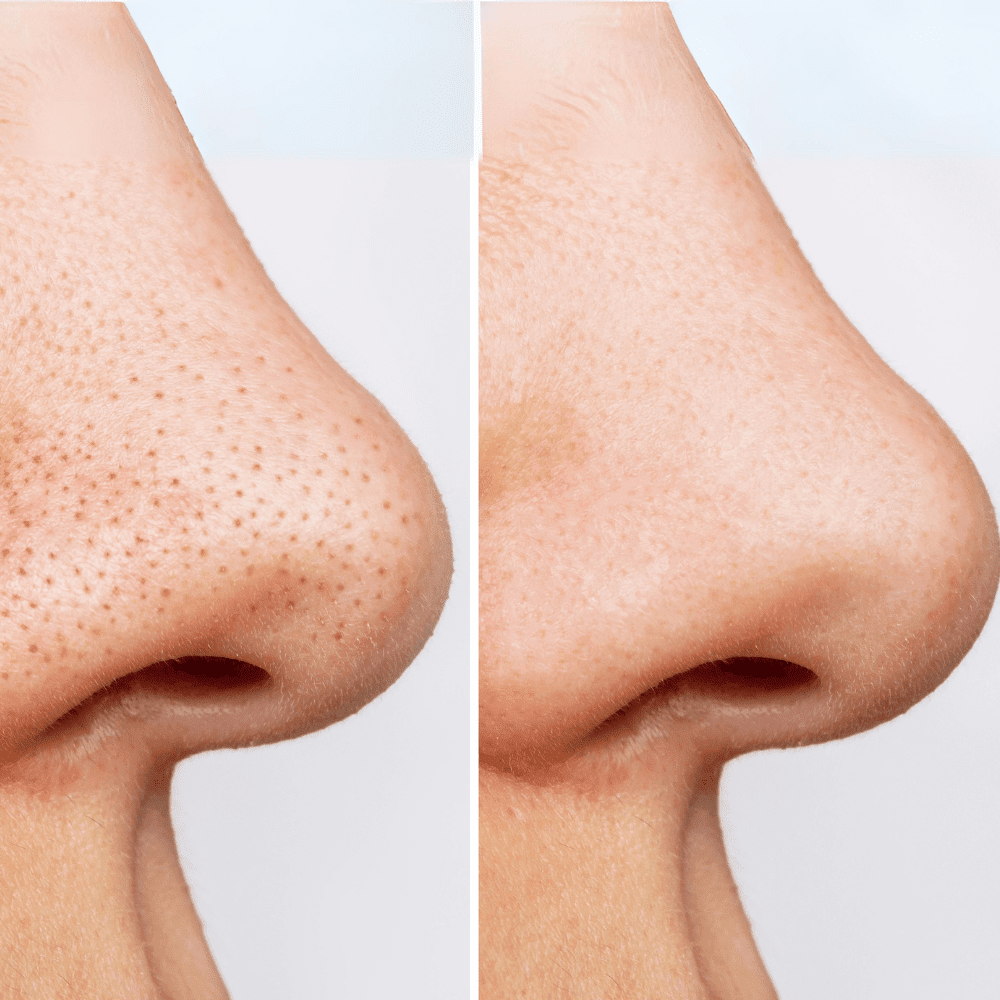 HEARTLEAF PORE CONTROL CLEANSING OIL 200 ml - ANUA - NADAUN - 8809640732829