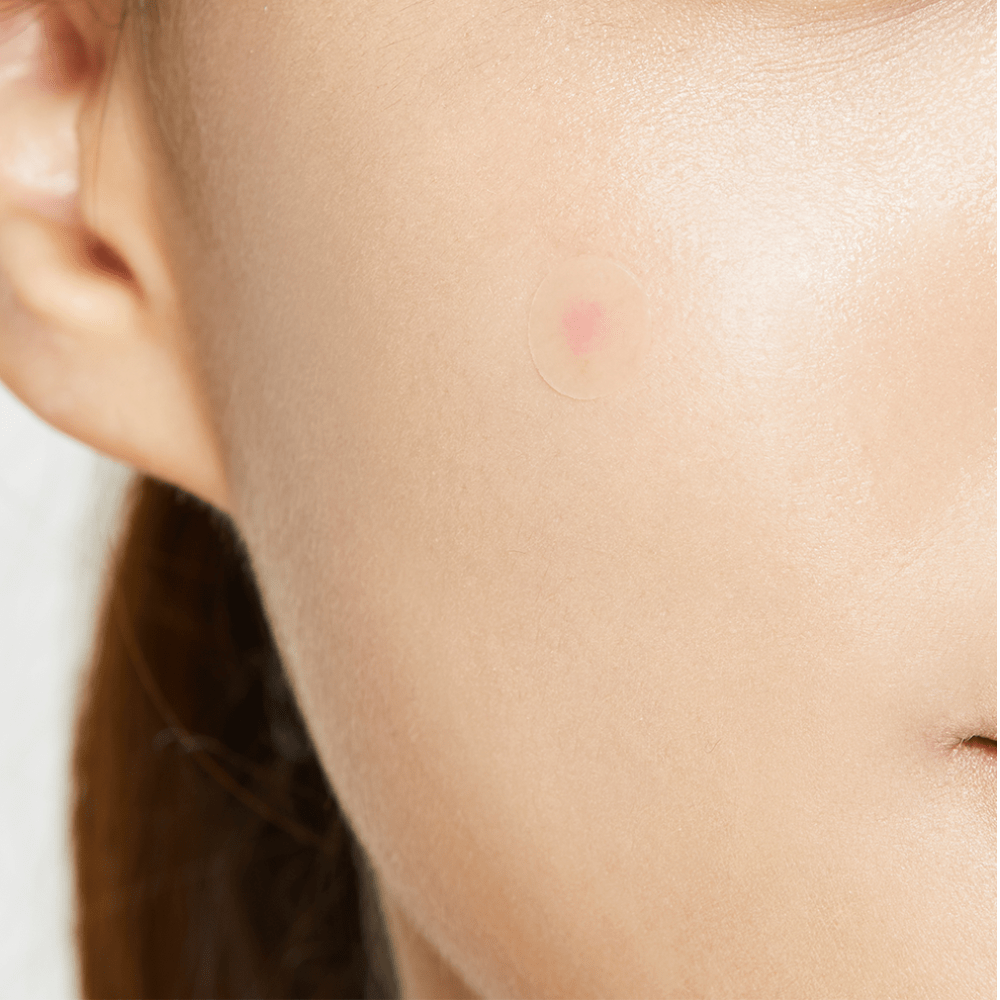 KIT Acne Pimple Master Patch 3 piezas (Parches para acné) - COSRX - NADAUN -